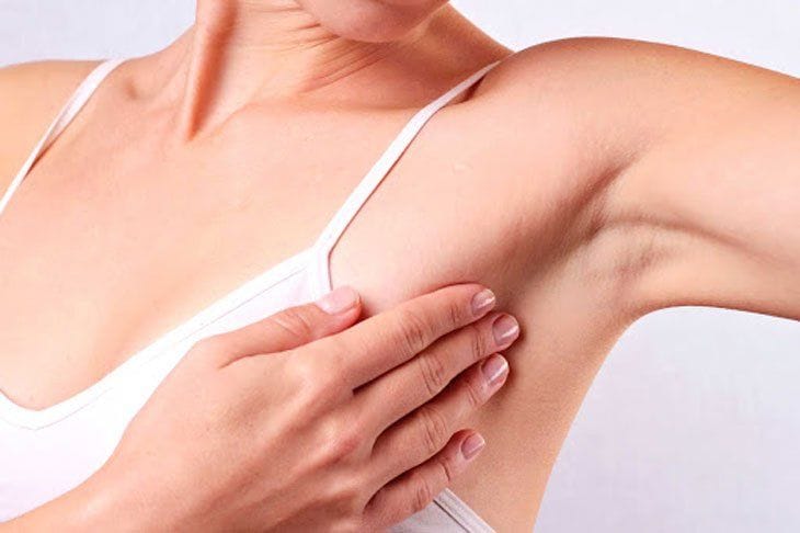 Nguyên nhân hình thành nếp nhăn ở nách