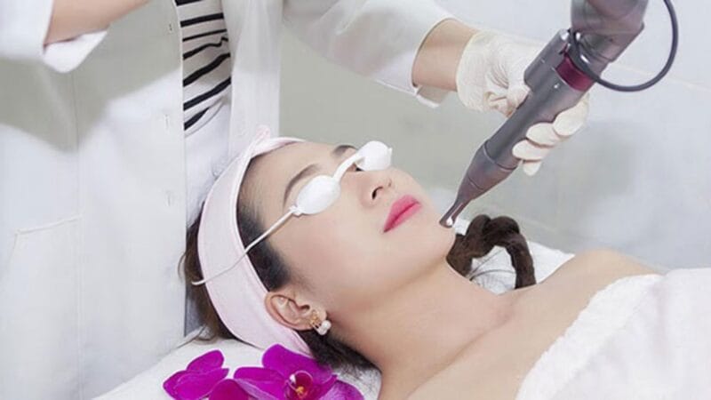 Laser treatment process for melasma