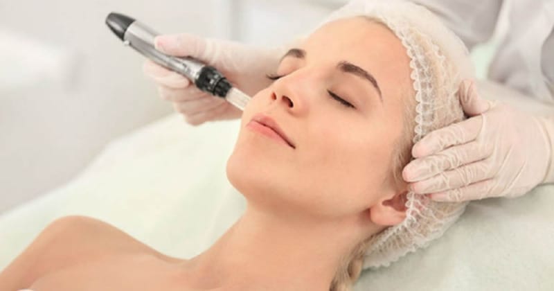 Quy trình điều trị nám công nghệ cao tại HBIO Clinic