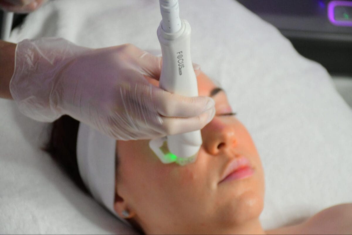 Quy trình RF Microneedling tại HIBO Clinic