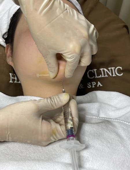 Sau tiêm botox bao lâu được nằm nghiêng an toàn?
