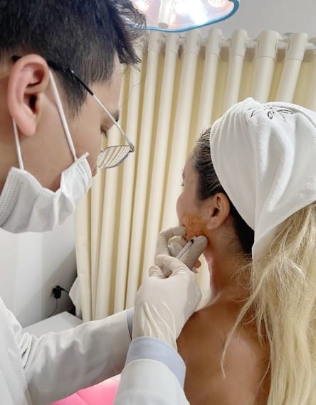 Tiêm Filler (Chất làm đầy)