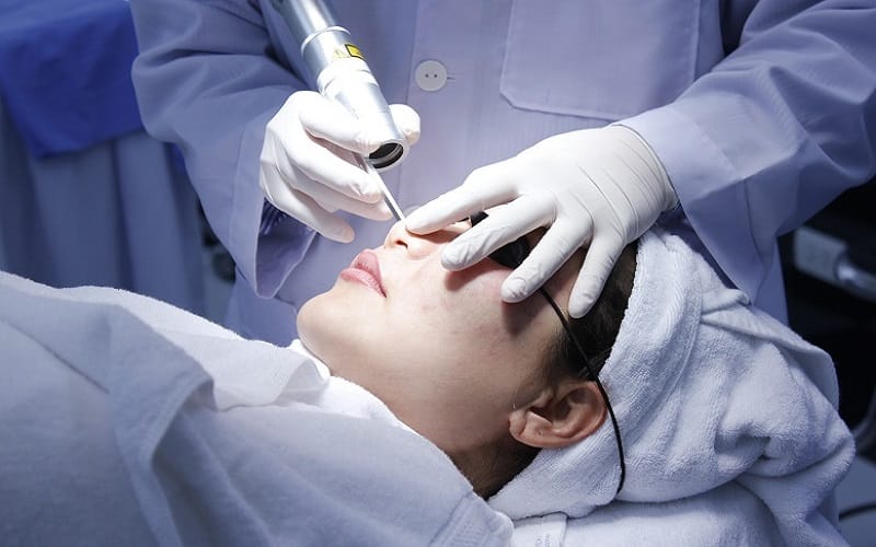 Benefits of Melasma Treatment