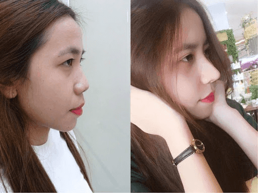 How to choose the right nose shape for your face