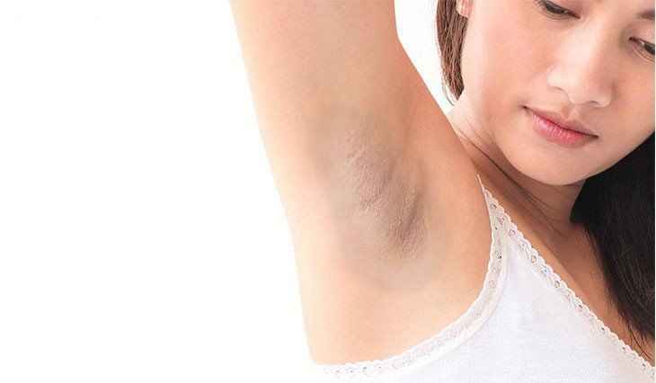 Cách trị thâm nách cho mẹ sau sinh