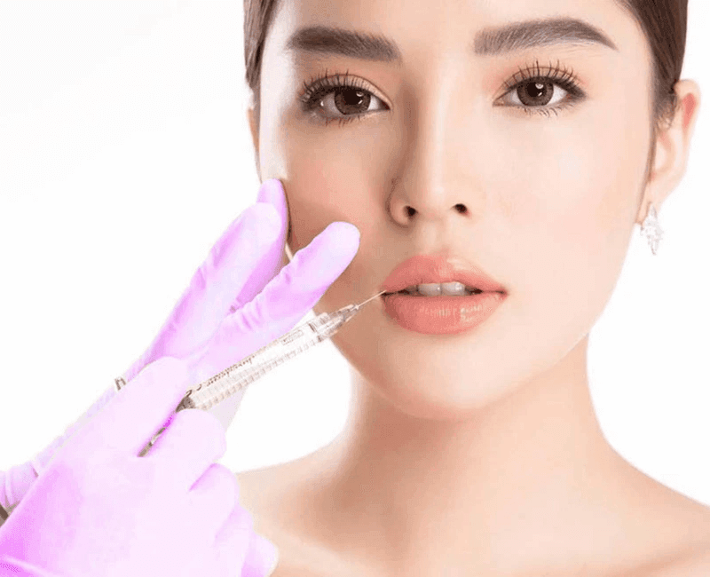Cơ sở tiêm filler uy tín, giúp hạn chế tối đa tình trạng bầm sau tiêm