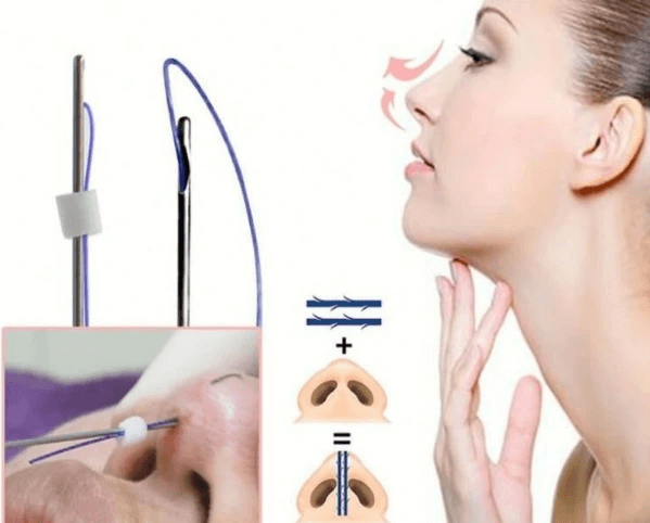 What is a pointed nose?