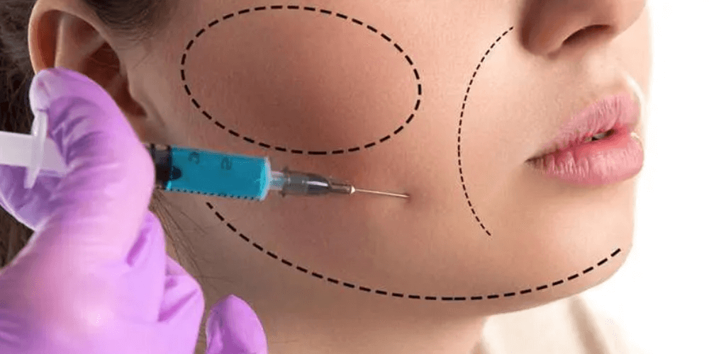Những đối tượng nên và không nên tiêm giảm mỡ má