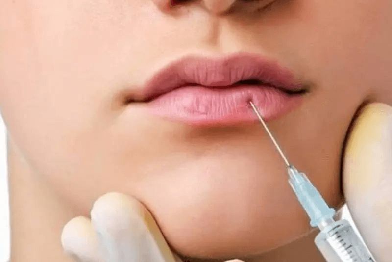 In which cases is filler injection needed?
