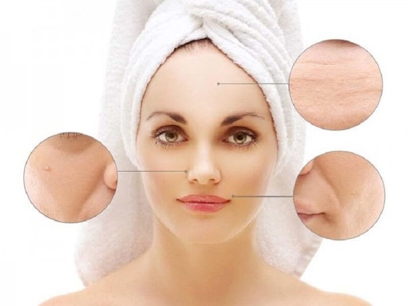 Những yếu tố ảnh hưởng đến chi phí căng da mặt