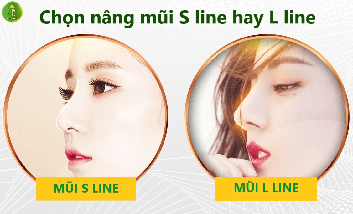 Comparing S line and L line nose: Which style enhances natural beauty?