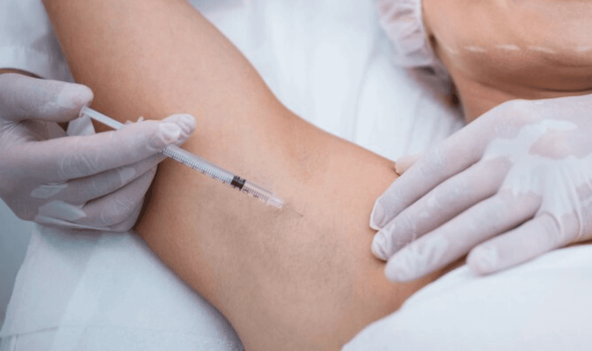 Tiêm botox trị hôi nách là gì?