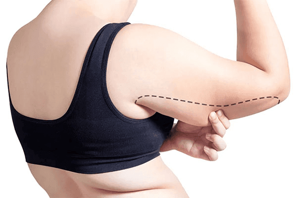 Ưu và nhược điểm của công nghệ tiêm gọn bắp tay