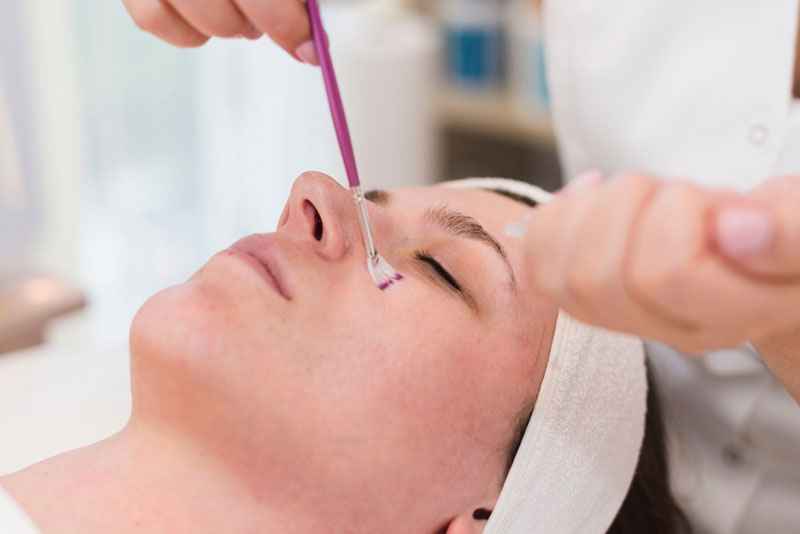 How to Treat Hidden Acne on Forehead Safely and Effectively
