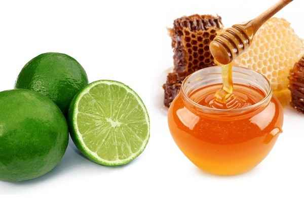 How to treat melasma at home with natural ingredients