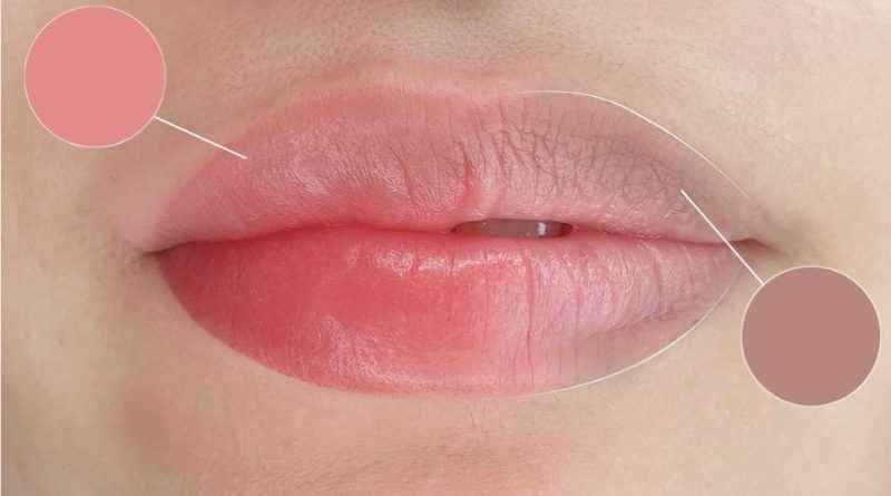 Chi phí khử thâm vùng môi dao động và phụ thuộc vào nhiều yếu tố