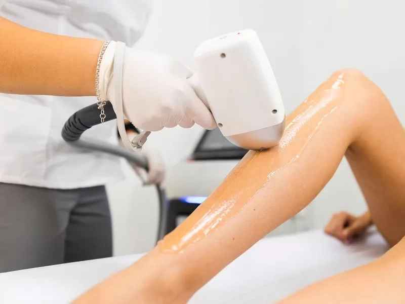 Có nên triệt lông chân không là câu hỏi được nhiều người quan tâm