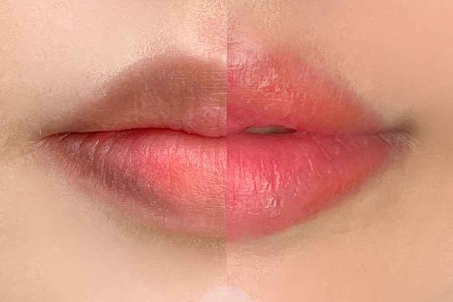 How long after lip darkening can you get lip color?