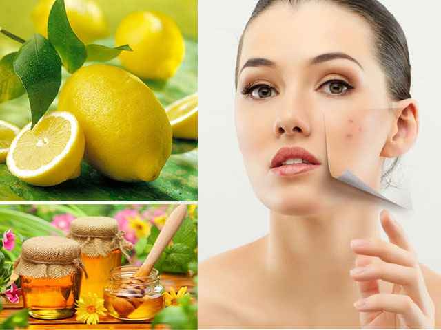 Một số nguyên liệu từ thiên nhiên trị thâm sẹo hiệu quả