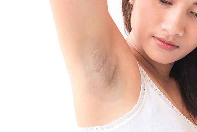 Causes of Dark Armpits