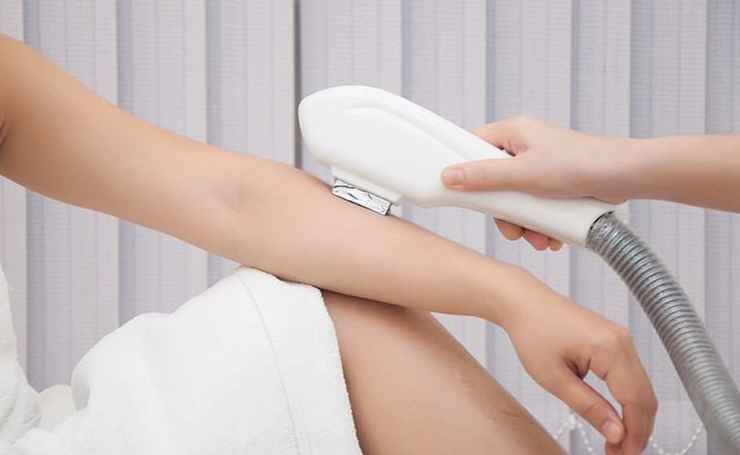 So sánh các công nghệ triệt lông