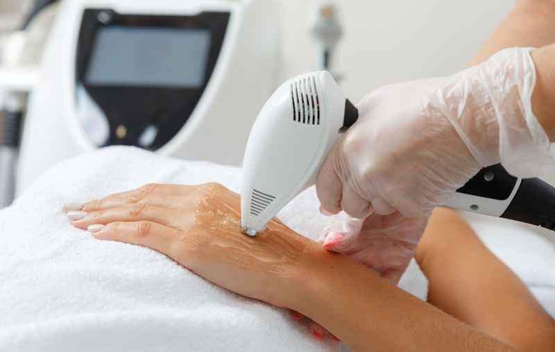 Sử dụng công nghệ Thermage trẻ hóa da tay