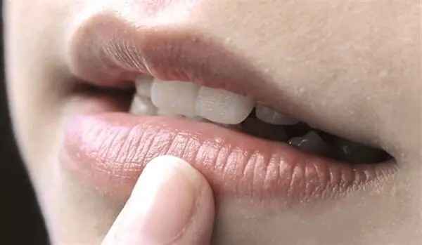 What Causes Dark Lips?