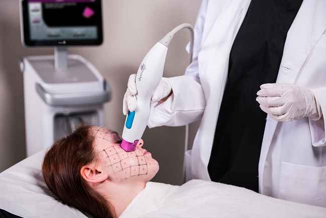 Thermage – Effective Smoothing and Firming