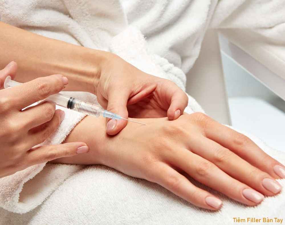 Tiêm filler trẻ hóa bàn tay