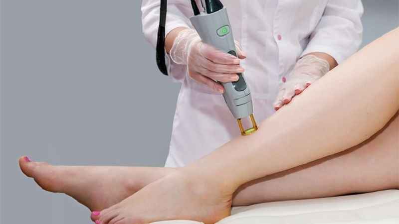 Trị sẹo thâm bằng laser