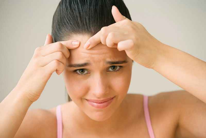 Popping hidden acne yourself can damage the skin and cause infection.