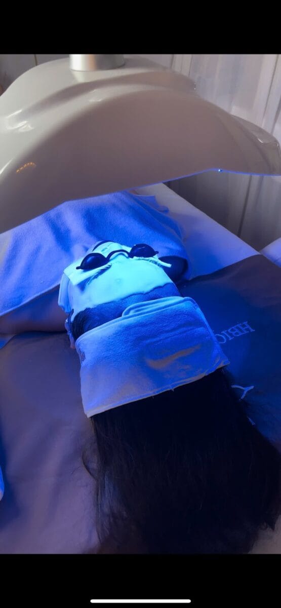 Ánh sáng xanh phù hợp với da bị mụn viêm, trứng cá