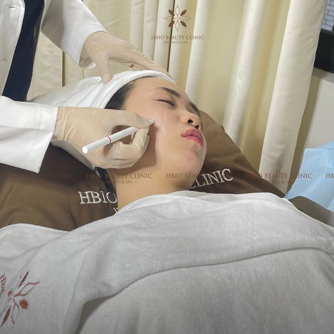 Cách khắc phục tình trạng tiêm hạ gò má bị đơ