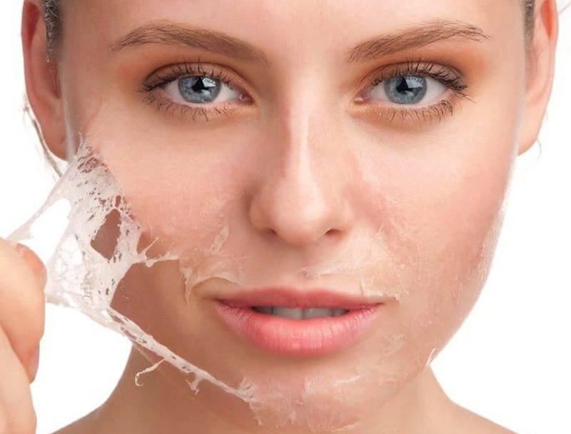 Cách phục hồi da bị bào mòn hiệu quả