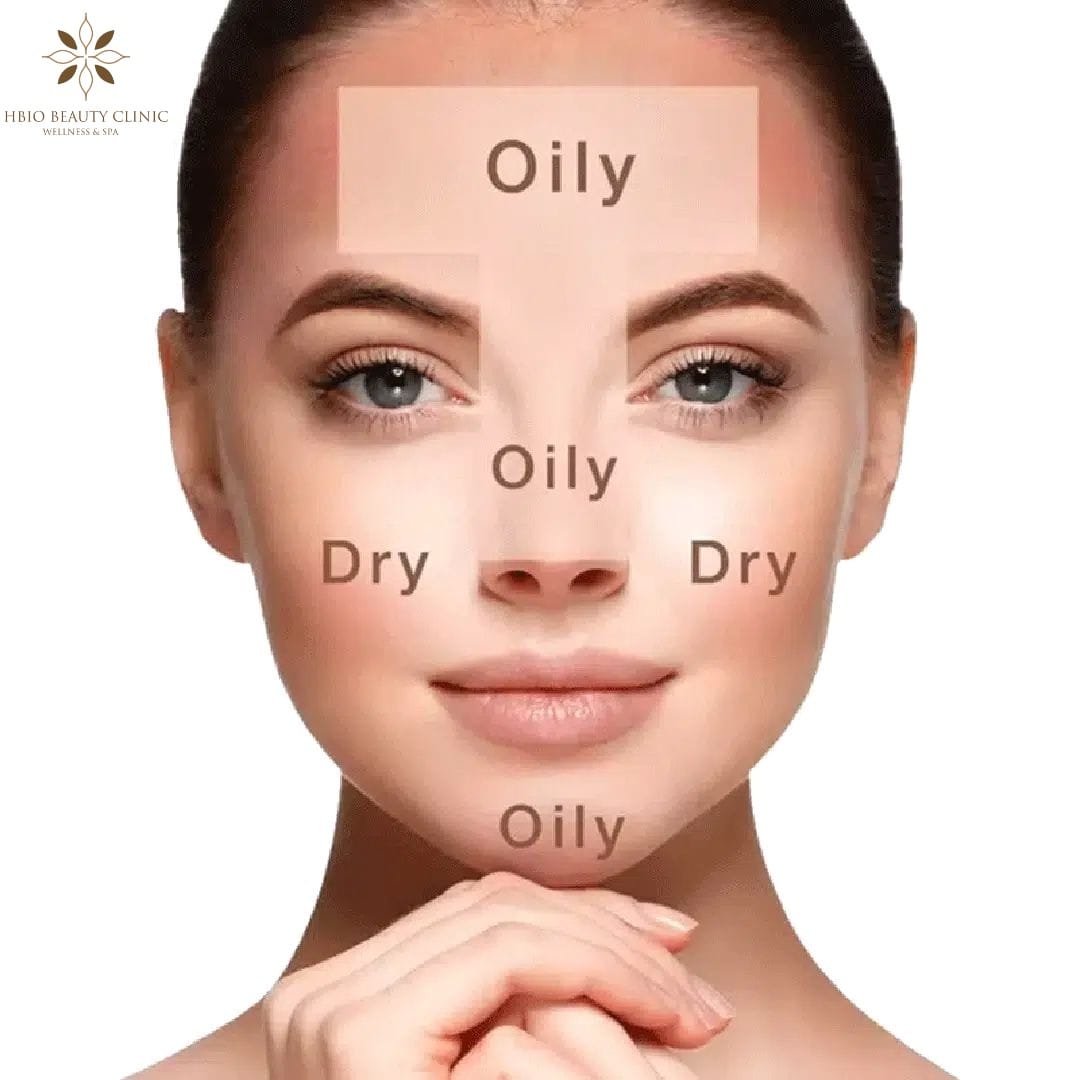 Da hỗn hợp là gì?