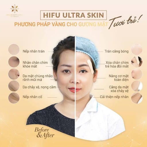 Để đạt hiệu quả tối ưu cần chăm sóc da sau HIFU đúng cách