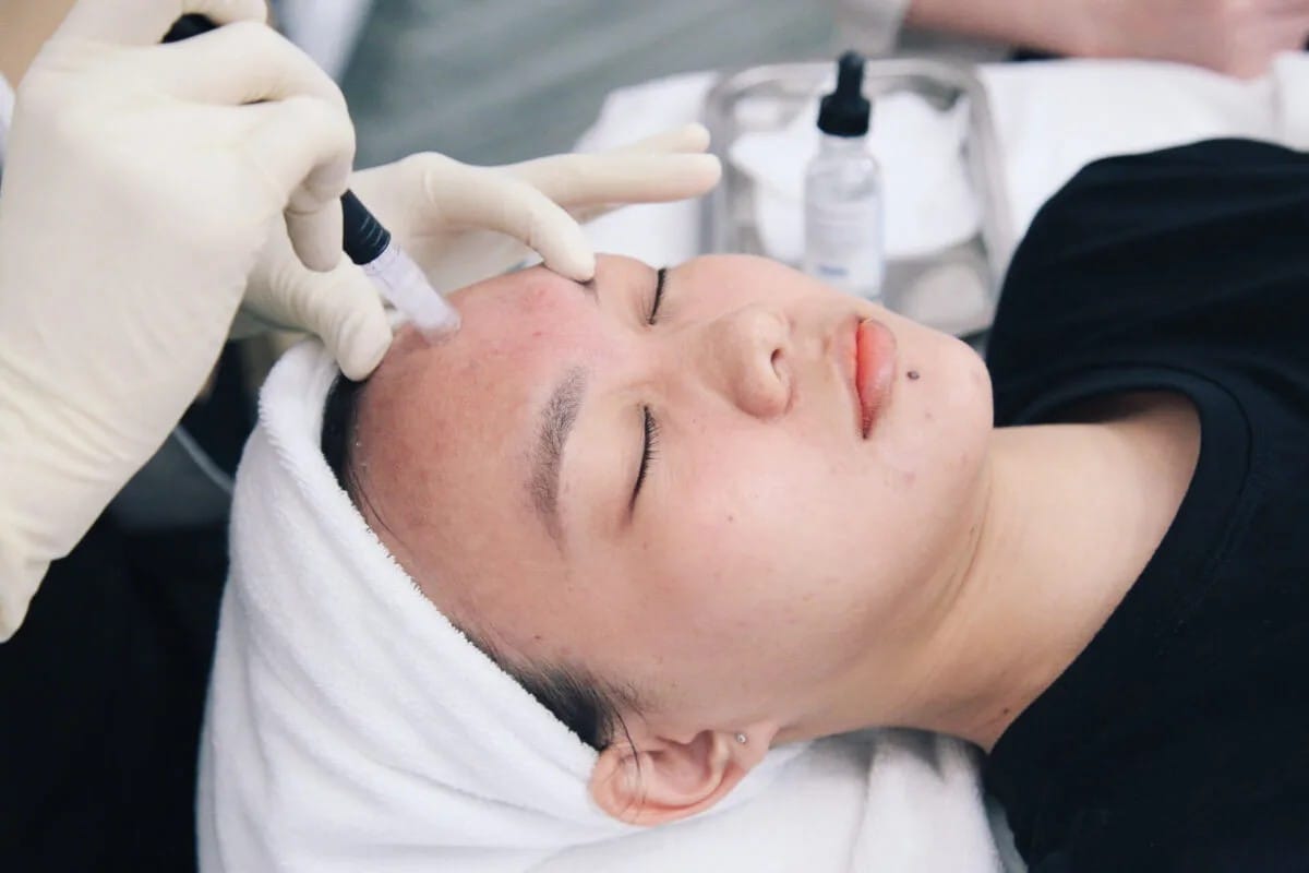 1 liệu trình trị mụn là bao lâu?