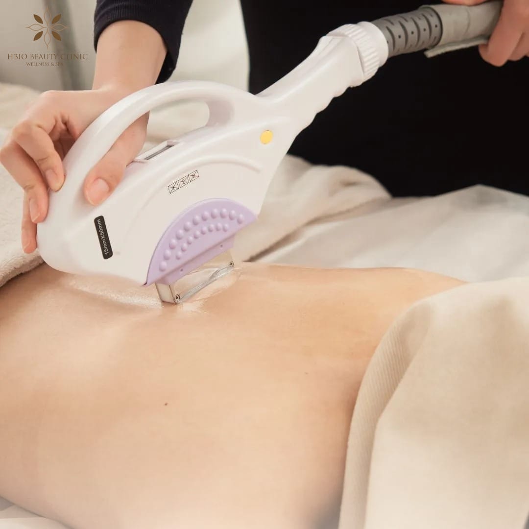 Điều trị thâm mụn lưng bằng ánh sáng sinh học