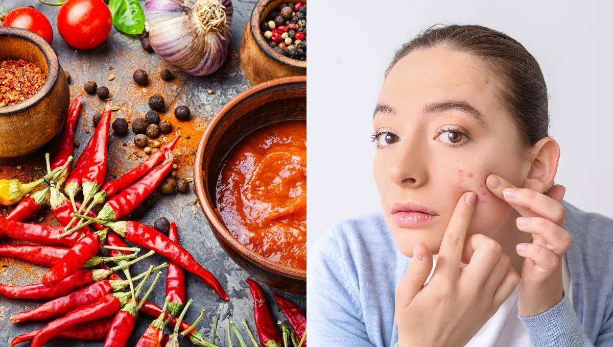 Hạn chế ăn đồ cay nóng