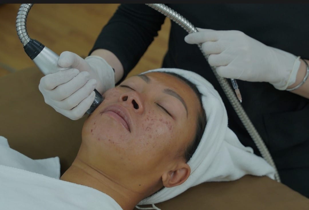 Hàng rào bảo vệ da