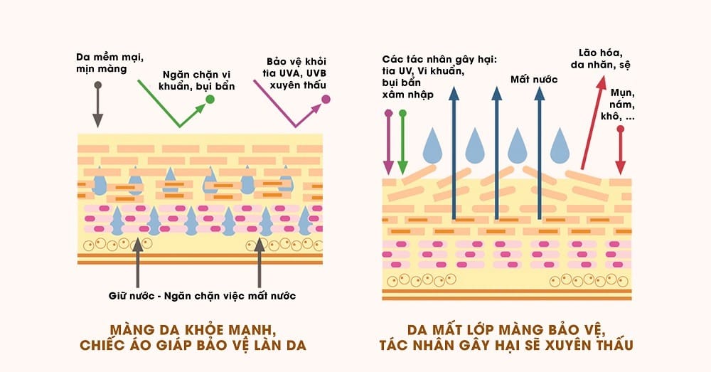 Hàng rào bảo vệ là gì?