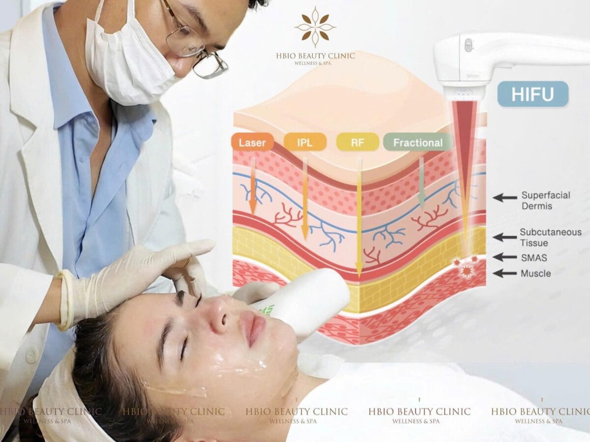 HIFU là công nghệ sóng siêu âm hội tụ cường độ cao