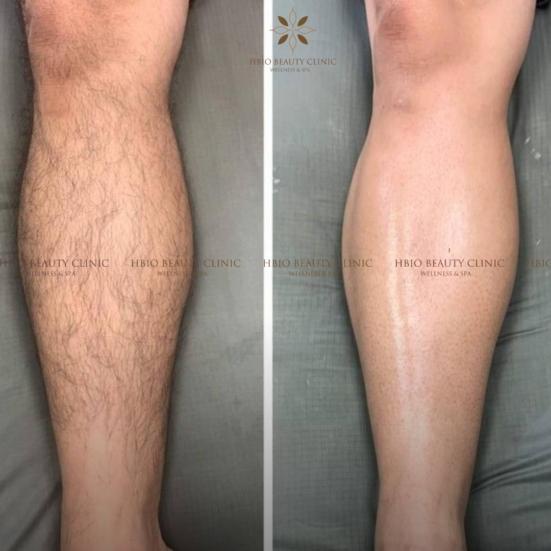 Hình ảnh thực tế khách hàng tại HBIO Clinic