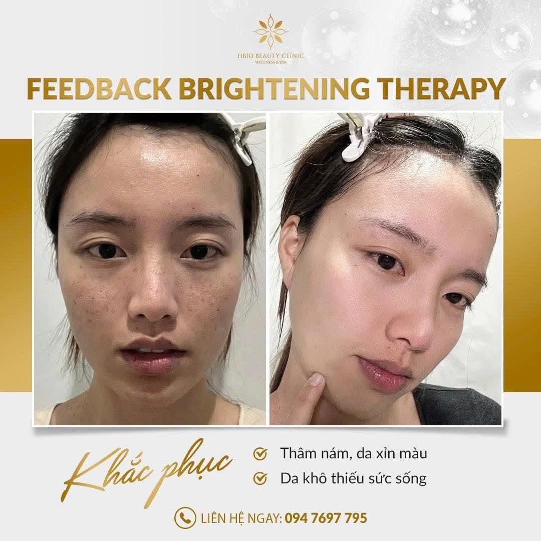 Hình ảnh trước và sau liệu trình chăm sóc da chuyên sâu HBIO