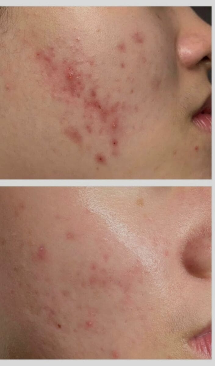 Kết quả sau khi điều trị