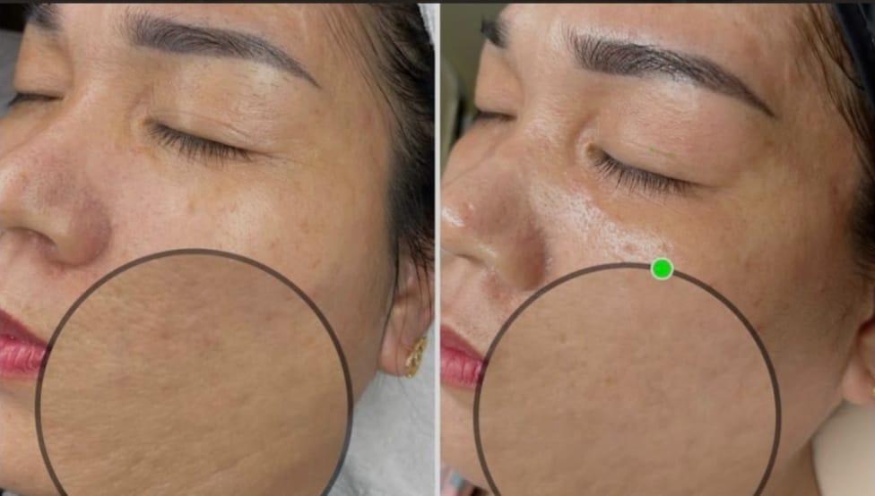 Kết quả sau khi điều trị