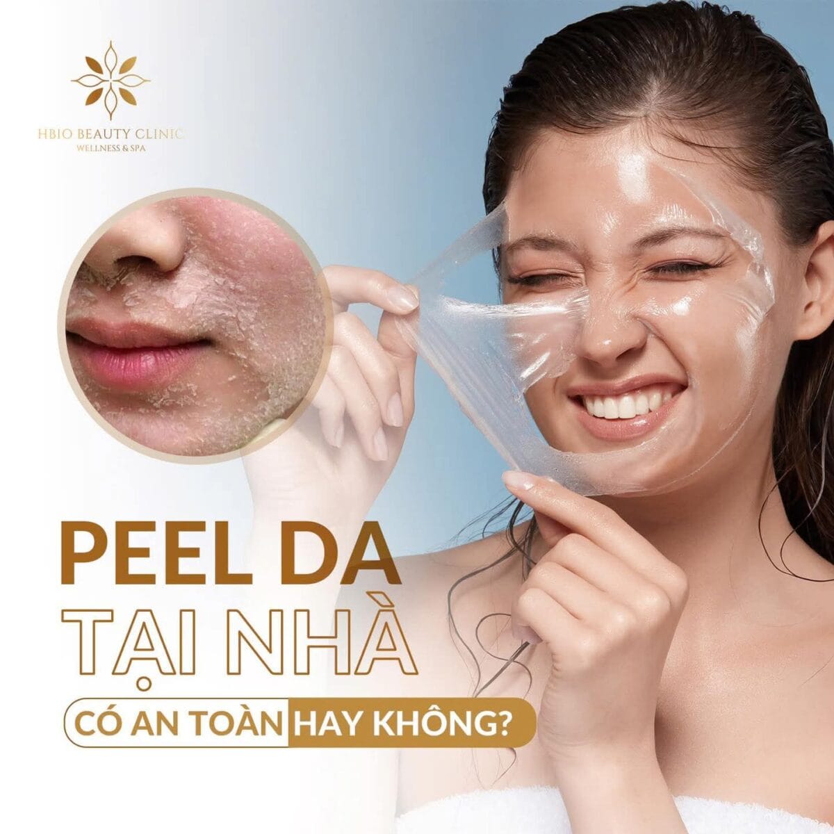 Không nên tự ý peel da nhạy cảm tại nhà