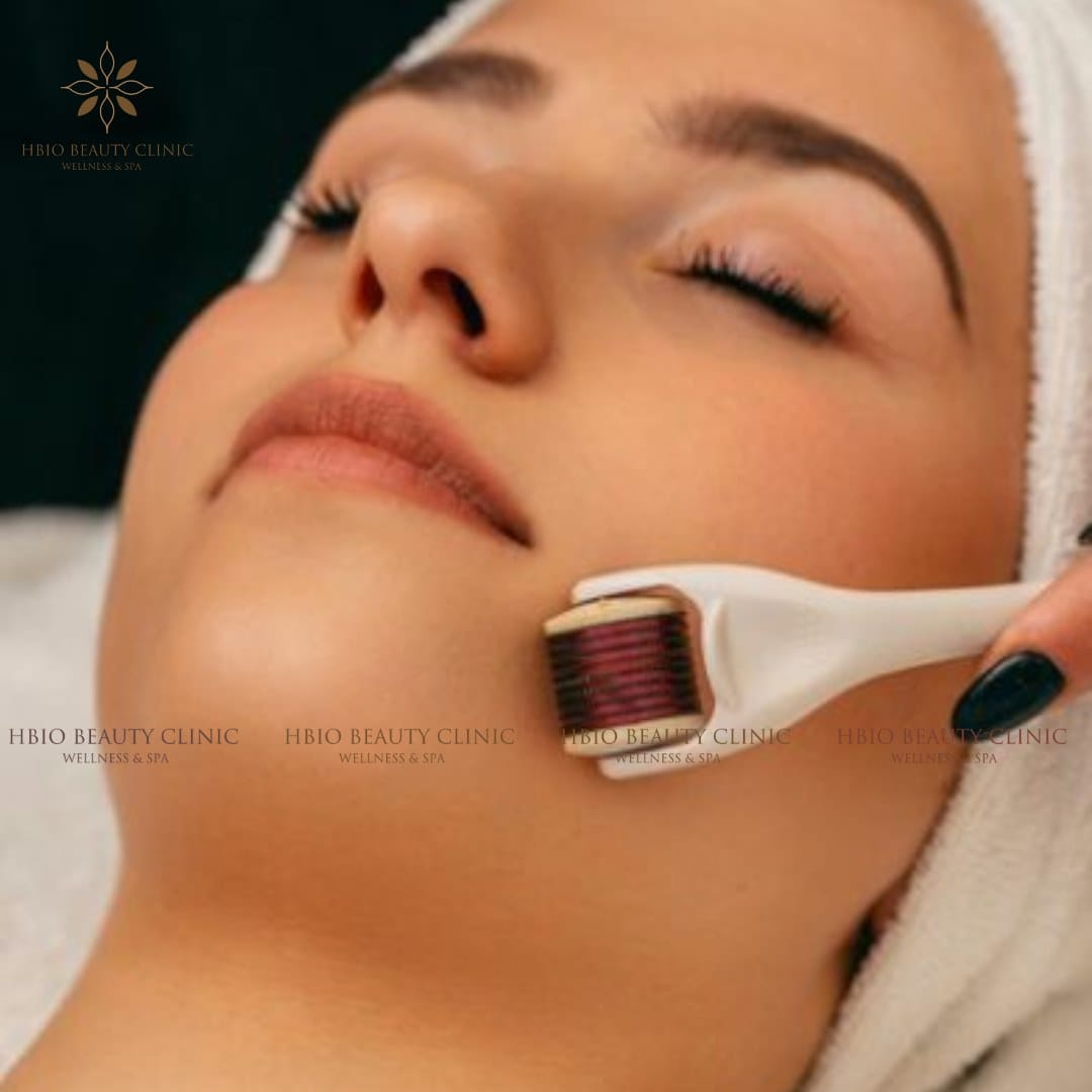 Lăn kim trị sẹo rỗ là phương pháp tái tạo da hiện đại