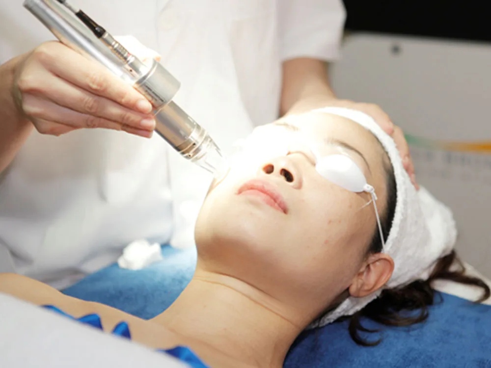 Laser Fractional CO2 – Công nghệ tái tạo da chuyên sâu tại Hbio