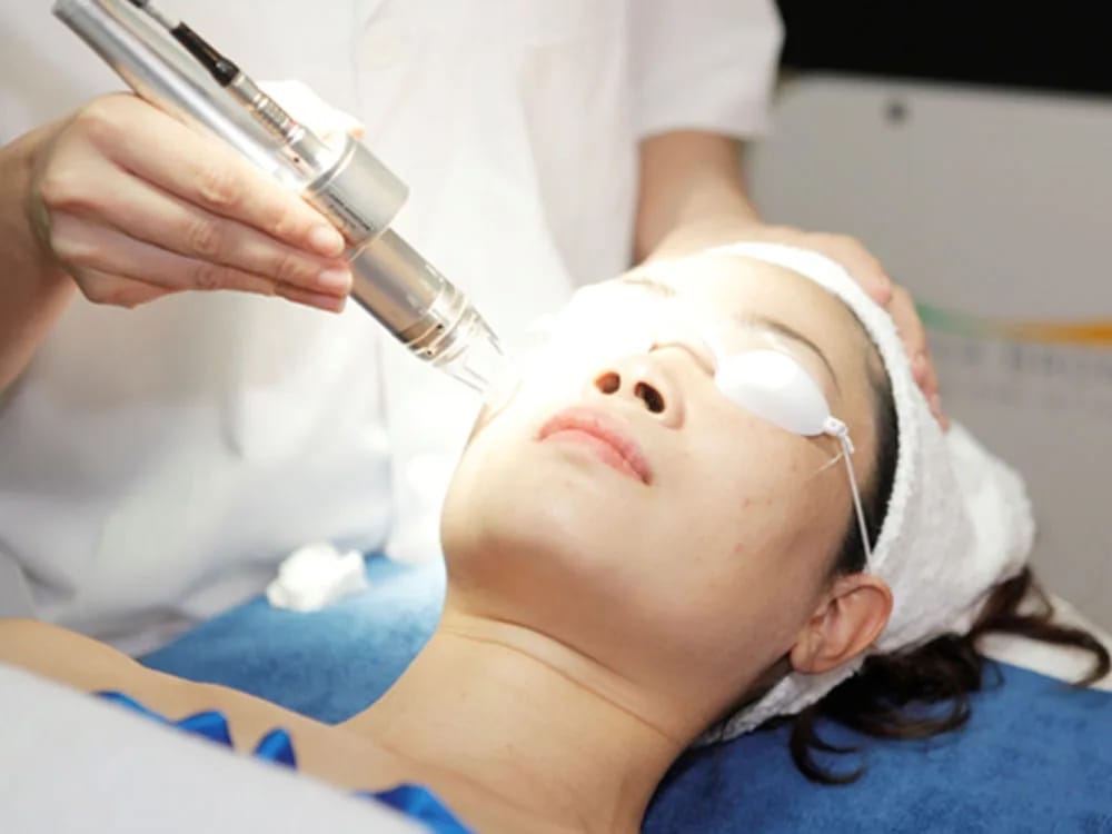 Laser Fractional CO2 – Công nghệ tái tạo da chuyên sâu tại Hbio